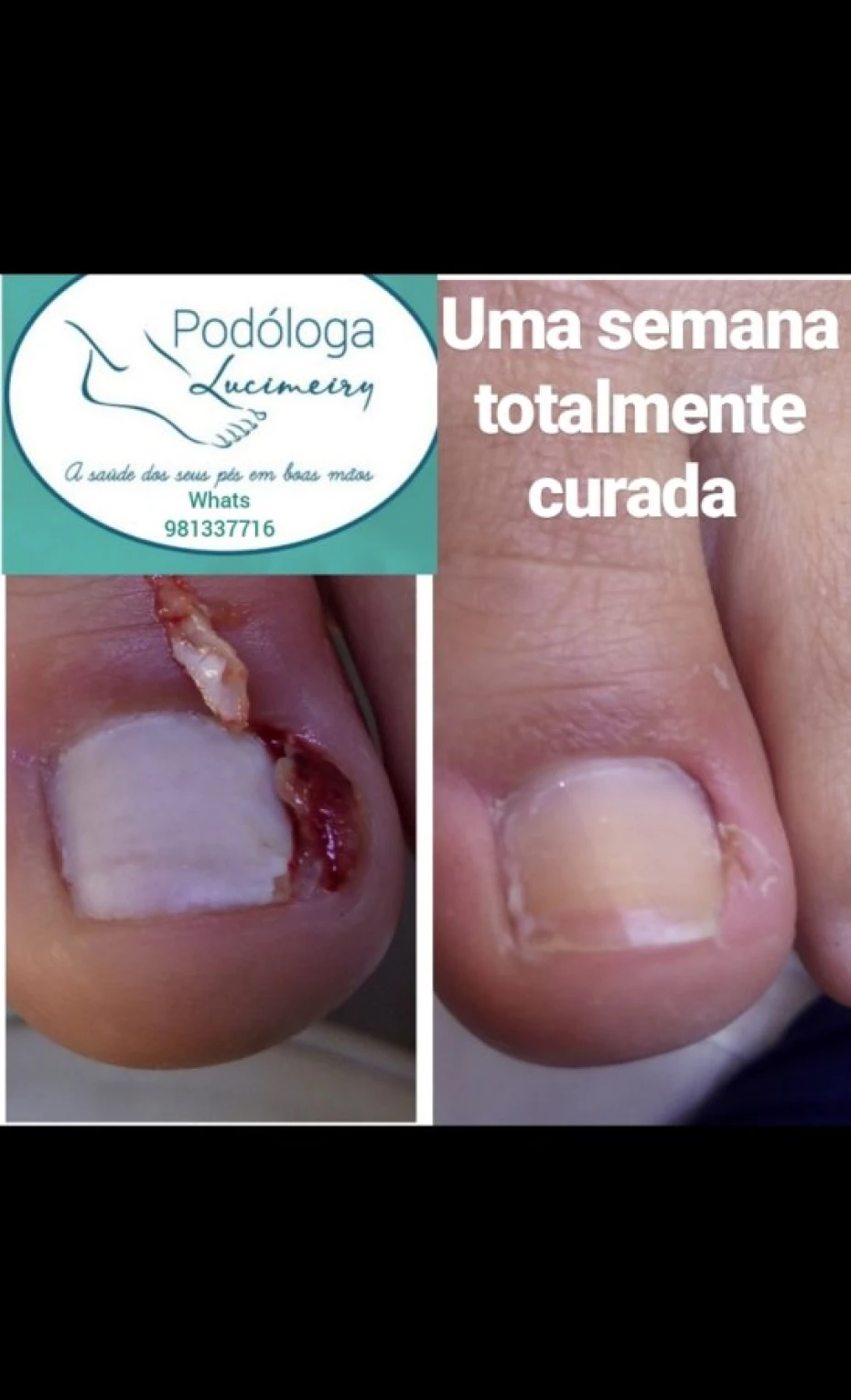 Foto 7:  — Lucimeiry Podóloga