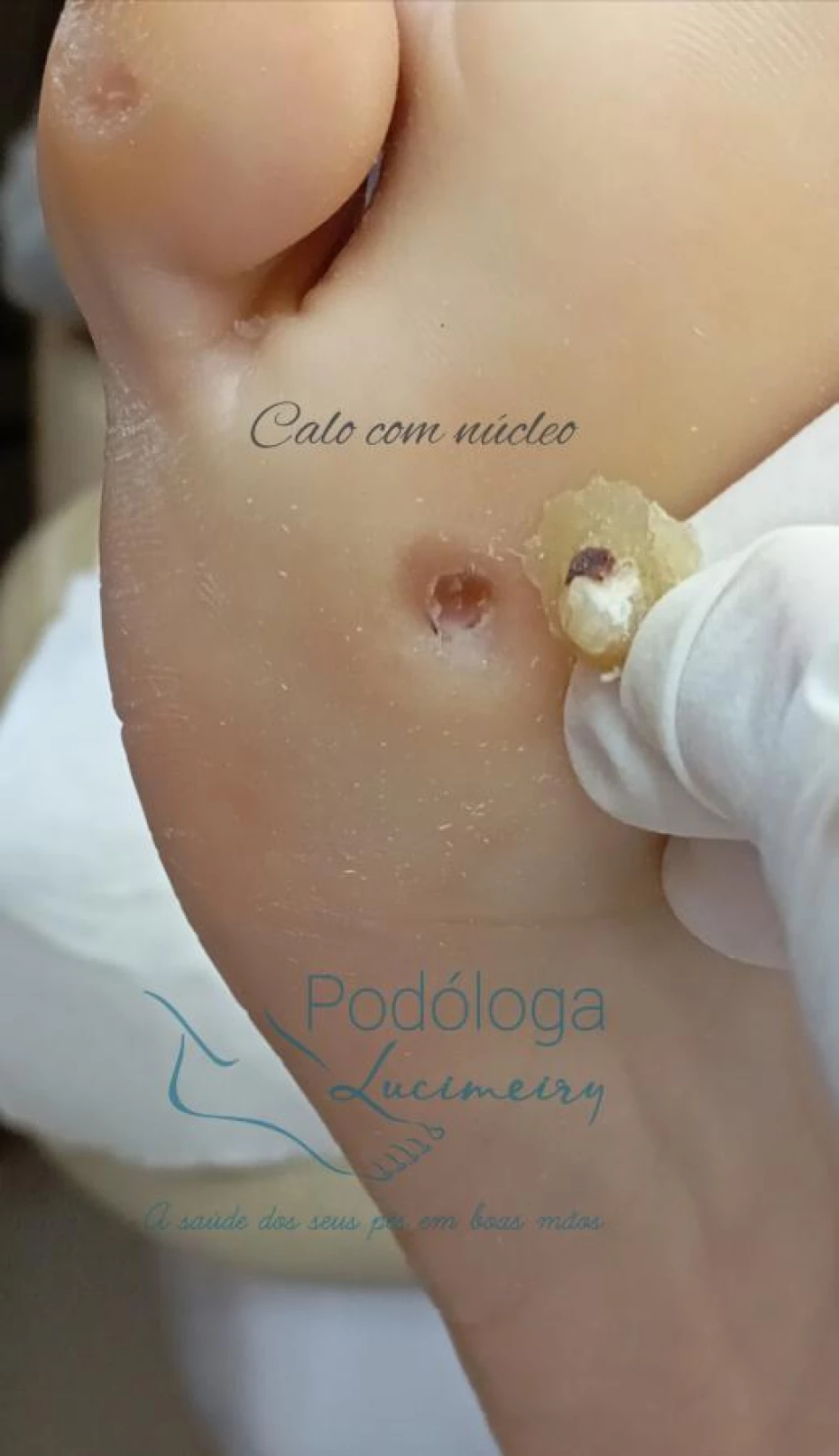 Foto 5:  — Lucimeiry Podóloga