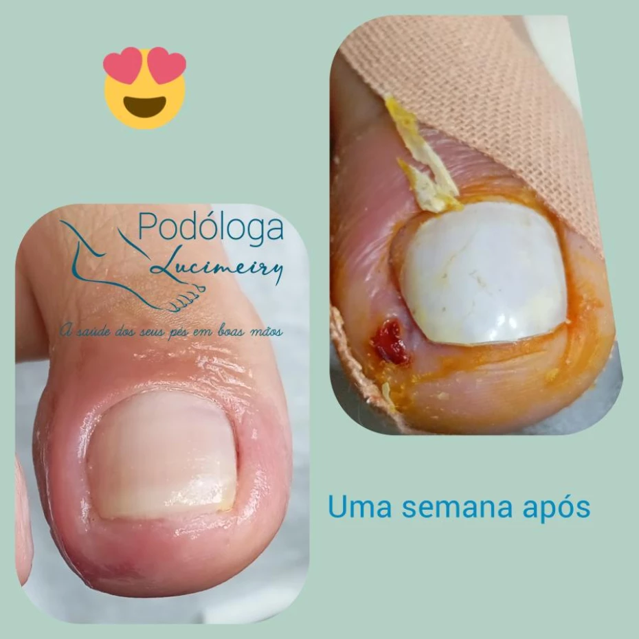 Foto 3:  — Lucimeiry Podóloga